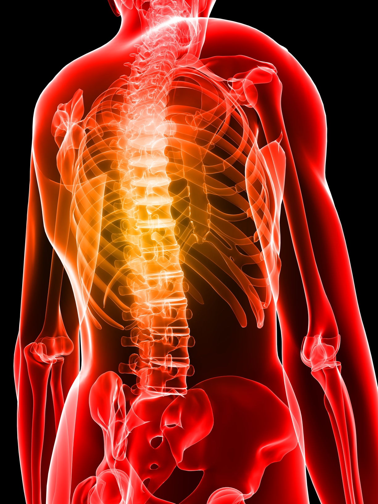 Dean Coulson - Inflammation