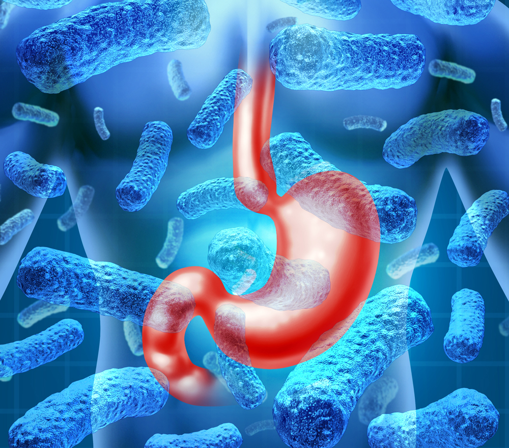 stomach infection